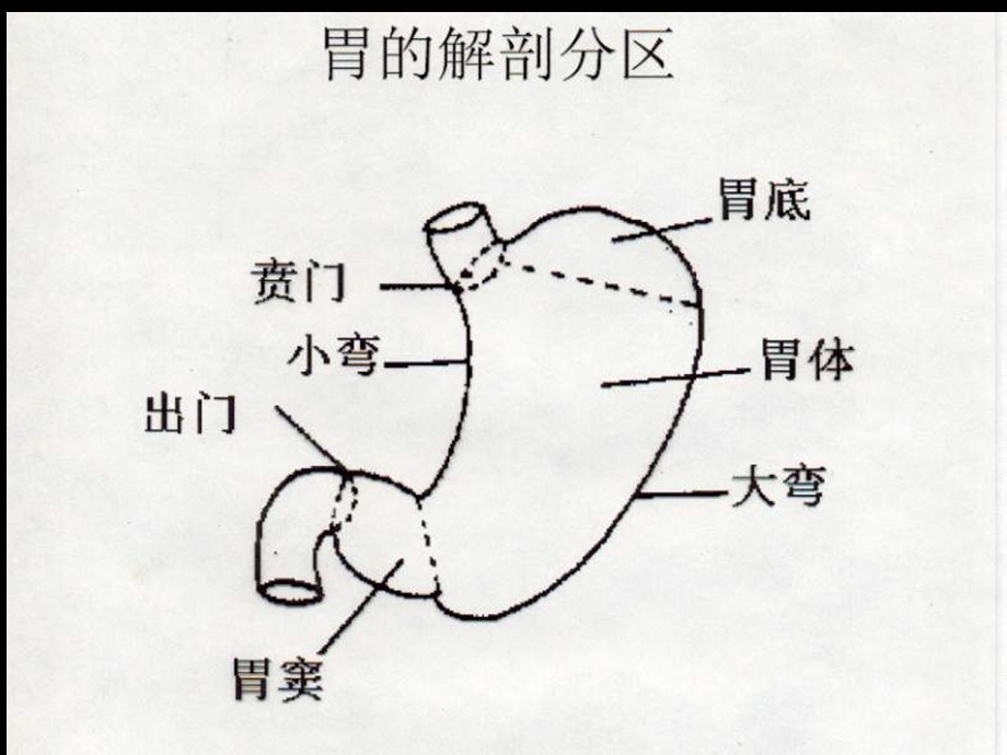 胃癌的外科治疗.ppt_第3页