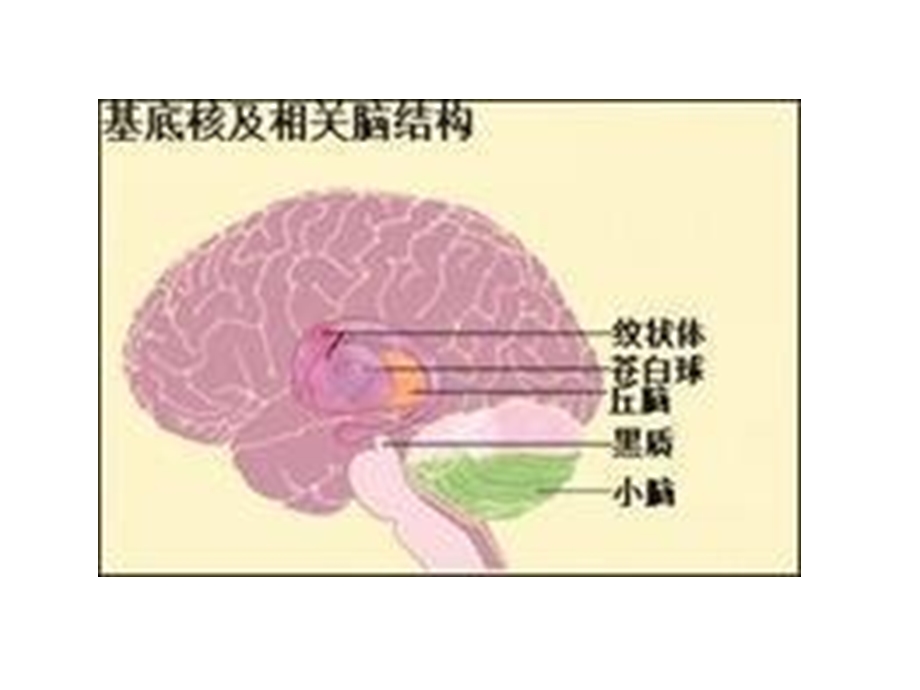 基底节区解剖位置关系图及临床.ppt_第3页