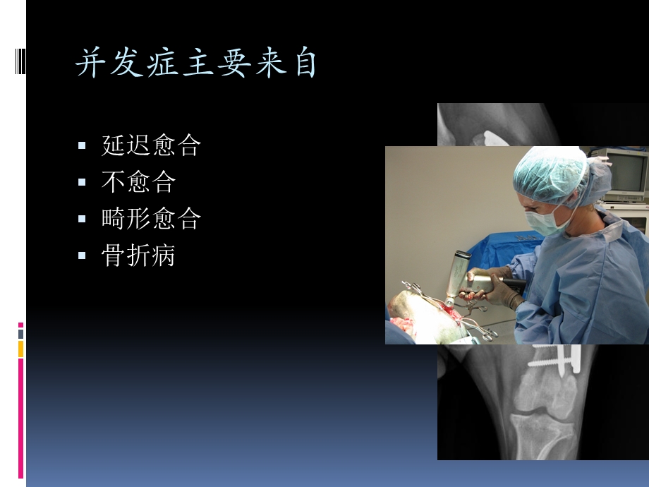 小动物骨折并发症.ppt_第2页