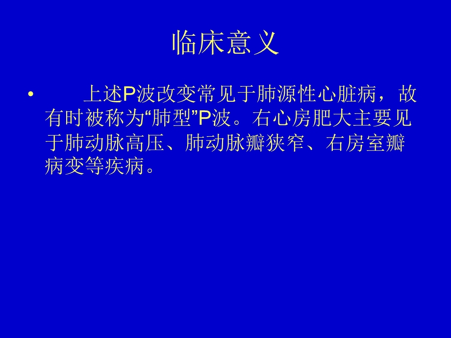 心电图典型图谱.ppt_第3页