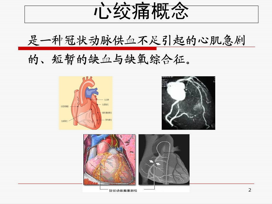 抗心绞痛药应用.ppt_第2页