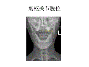 骨关节创伤图片 ppt课件.ppt