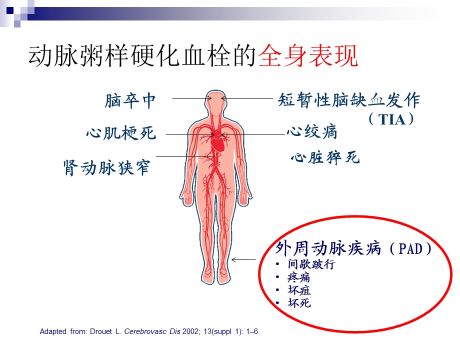 心脑血管疾病的预防-王海俊.ppt_第3页