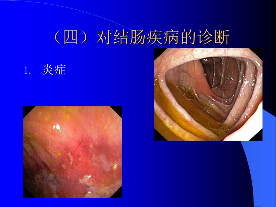 内镜检查4.ppt_第3页