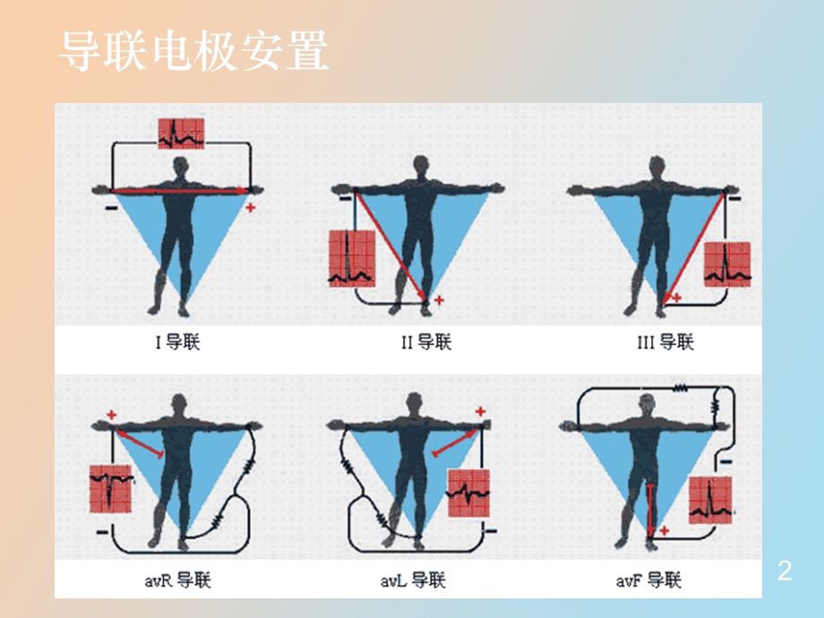 心电图的阅读方法.ppt_第2页