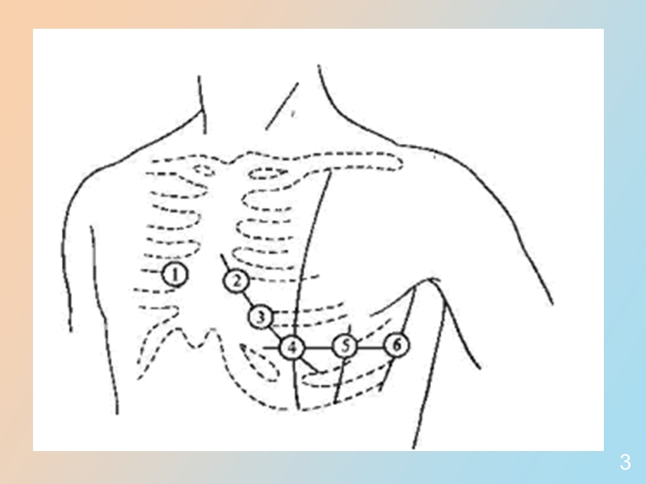心电图的阅读方法.ppt_第3页