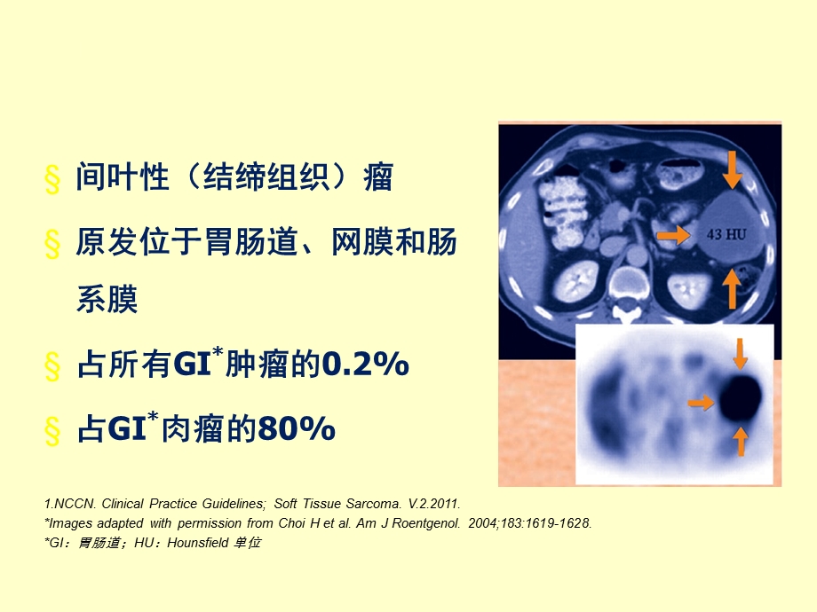 胃肠道间质瘤(GIST)综合治疗经验分享.ppt_第3页