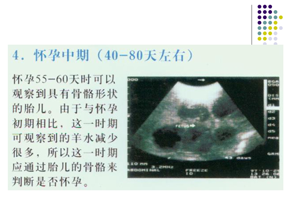 母猪怀孕时B超检测的图片.ppt_第3页