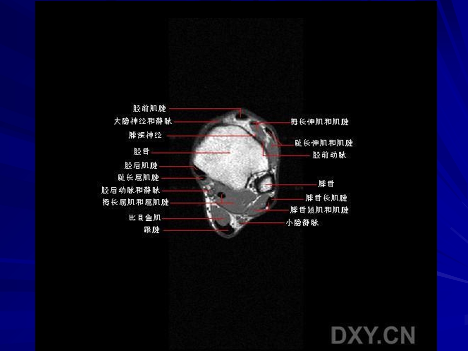 正常踝关节mr解剖.ppt_第2页