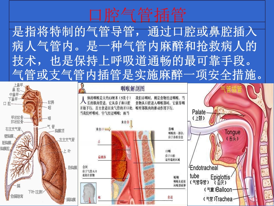 经口腔气管插管的方法及护理.ppt_第2页