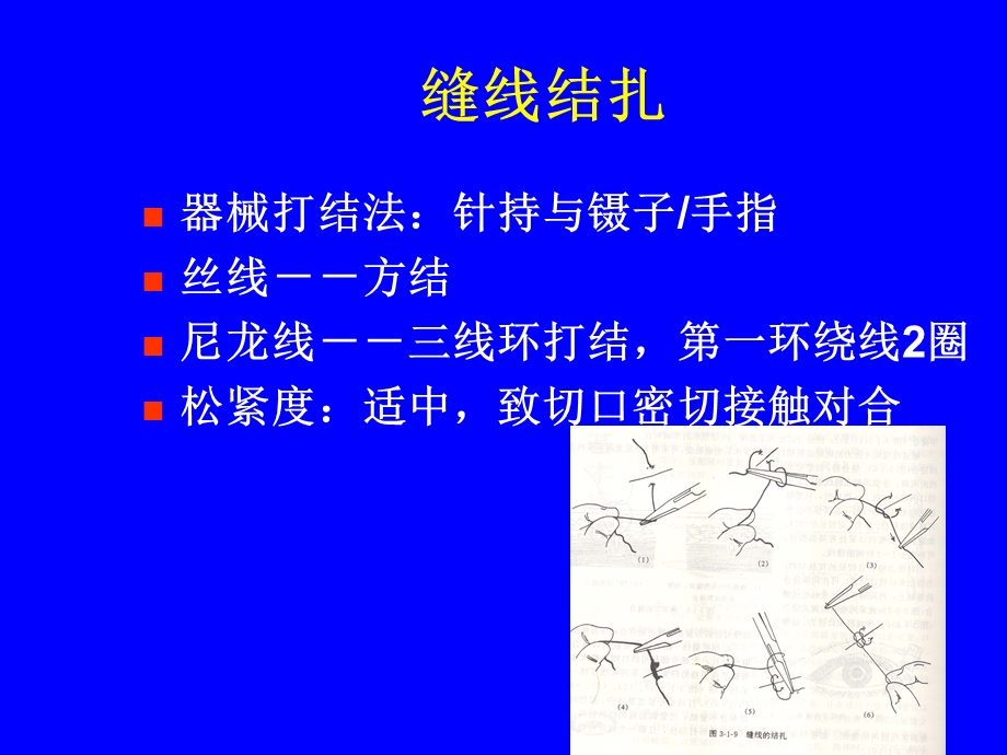 眼科显微手术器械及基本技能.ppt_第3页