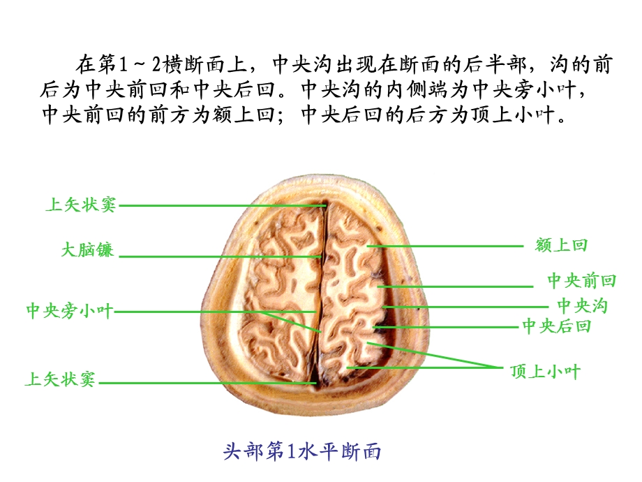 头颈断面解剖学.ppt_第1页