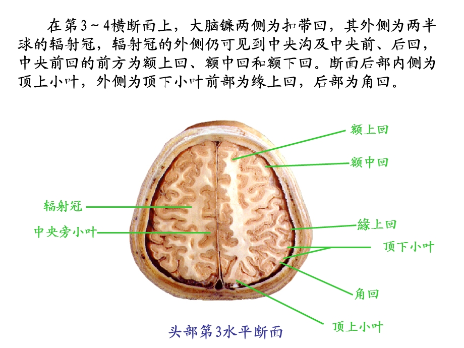 头颈断面解剖学.ppt_第3页