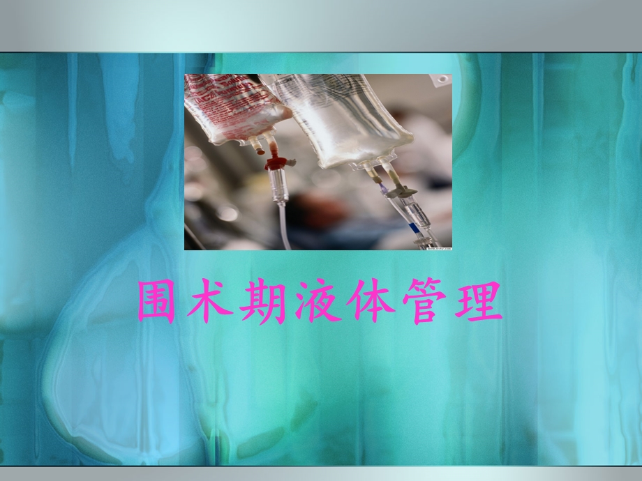 围术期液体管理.ppt_第1页