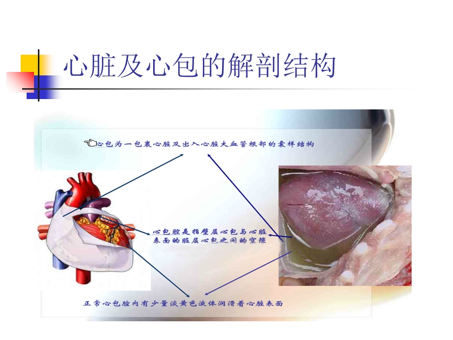 心脏术后合并出血及急性心包填塞的观察及护理.ppt_第2页