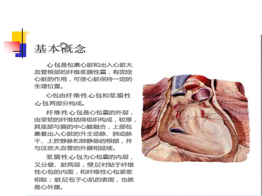 心脏术后合并出血及急性心包填塞的观察及护理.ppt_第3页