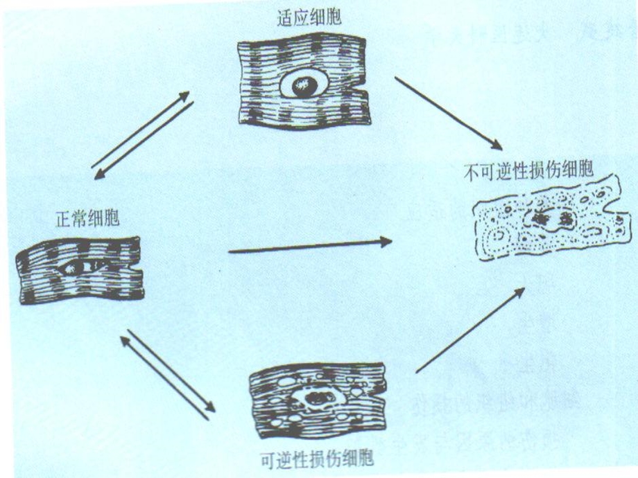 细胞和组织的损伤与修复.ppt_第2页