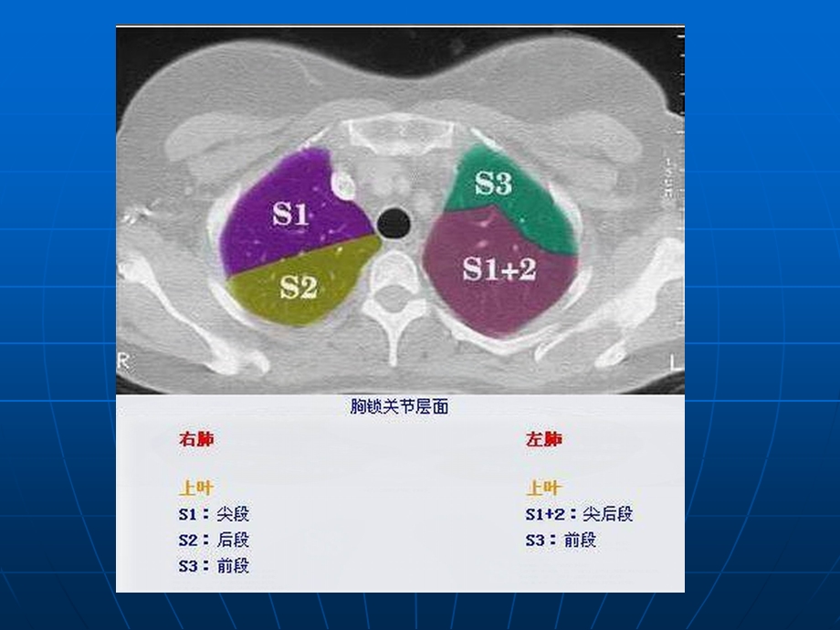 胸部CT肺段图解.ppt_第2页