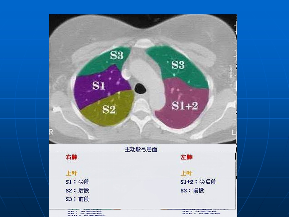 胸部CT肺段图解.ppt_第3页