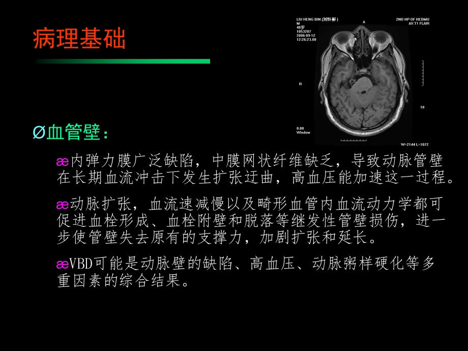 椎基底动脉扩张延长症.ppt_第3页