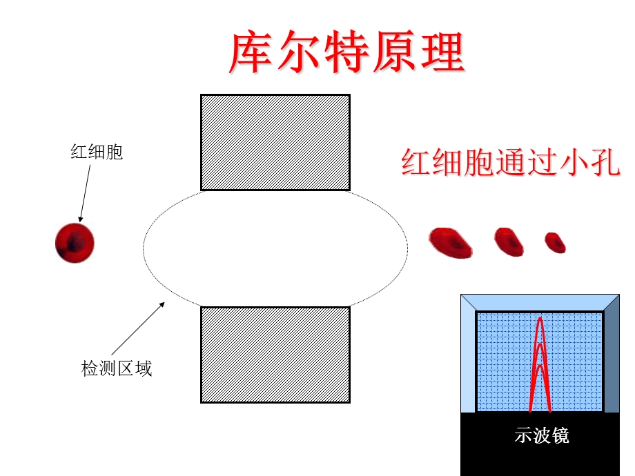 血细胞直方图和散点图的临床意义.ppt_第3页