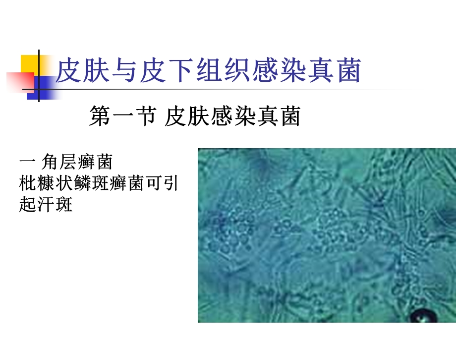 皮肤与皮下组织感染真菌.ppt_第1页