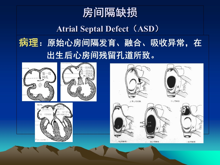 心血管病影像诊断.ppt_第3页