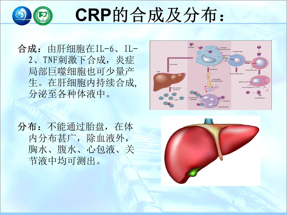 CRP与PCT的比较.ppt_第3页