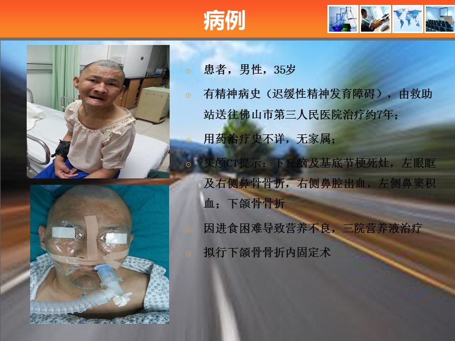 2015精神病患者的麻醉.ppt_第2页