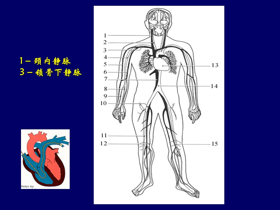 CVP穿刺及漂浮导管使用详解.ppt_第2页