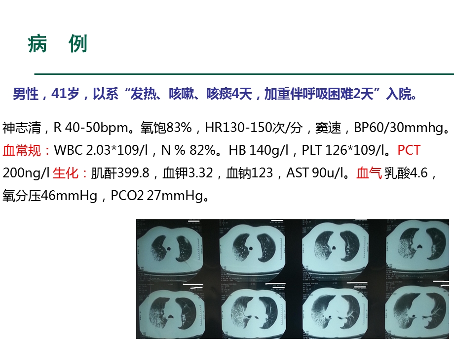 ESBLs的耐药机制及抗菌药物应用原则.ppt_第2页