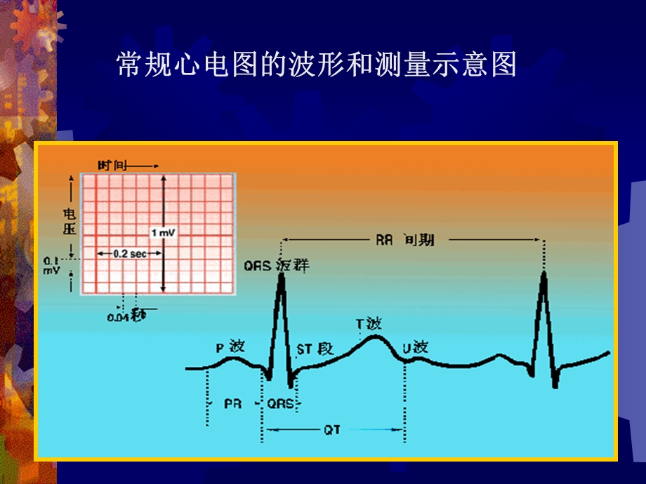 心电图的诊断和分析.ppt_第2页