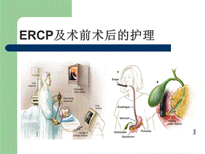 ERCP及术前术后护理.ppt