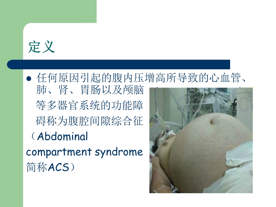 ACS腹腔间隙综合症.ppt_第1页