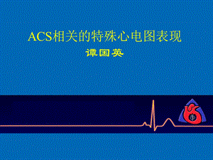 ACS相关的特殊心电图表现.ppt