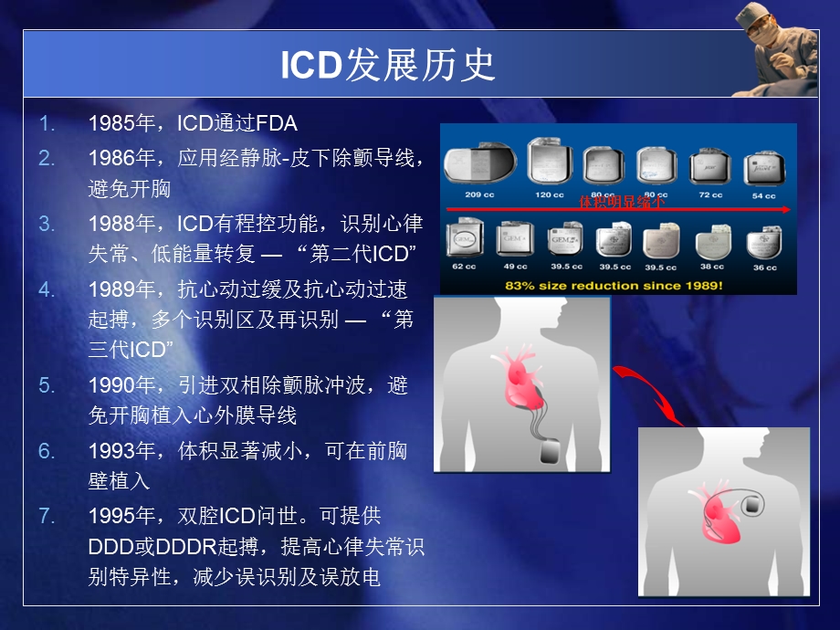 ICD一级预防的新认识.ppt_第3页