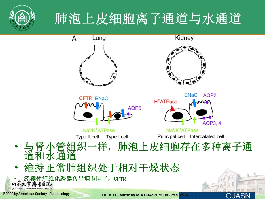 ARDS患者液体管理策略.ppt_第3页