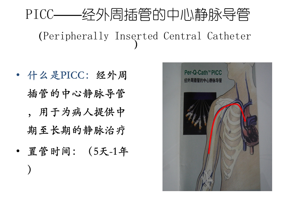 PICC维护常见问题及护理.ppt_第3页