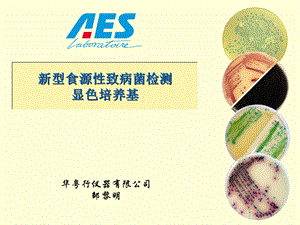 AES显色培养基.ppt