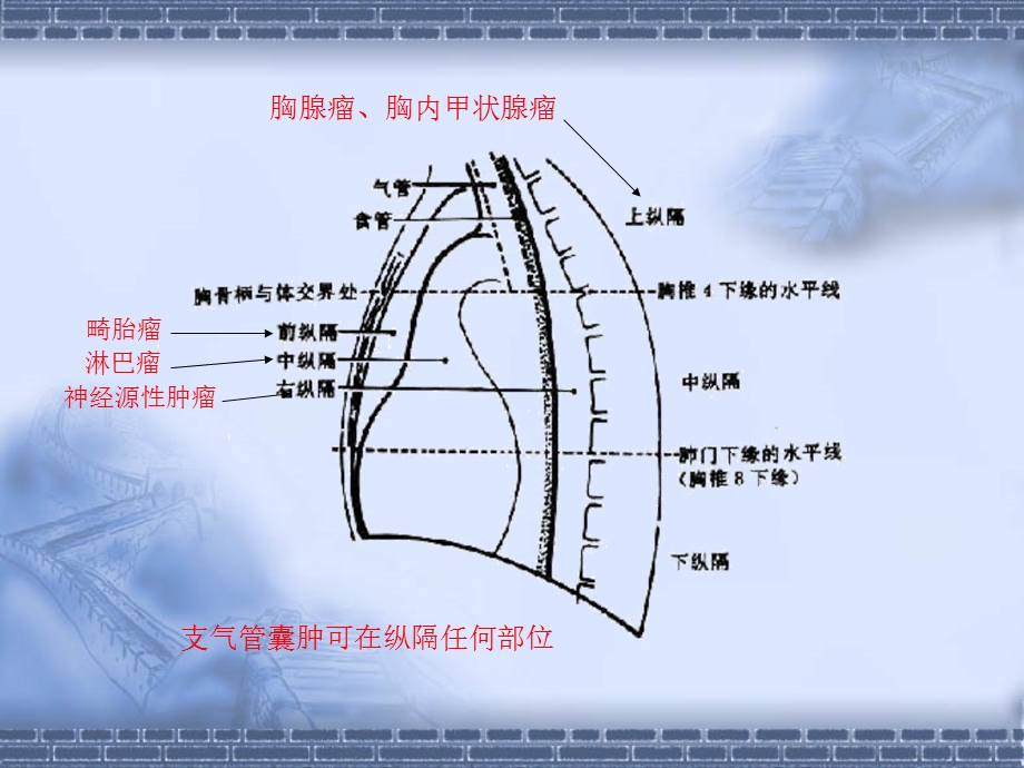 CT纵隔淋巴结分区.ppt_第2页