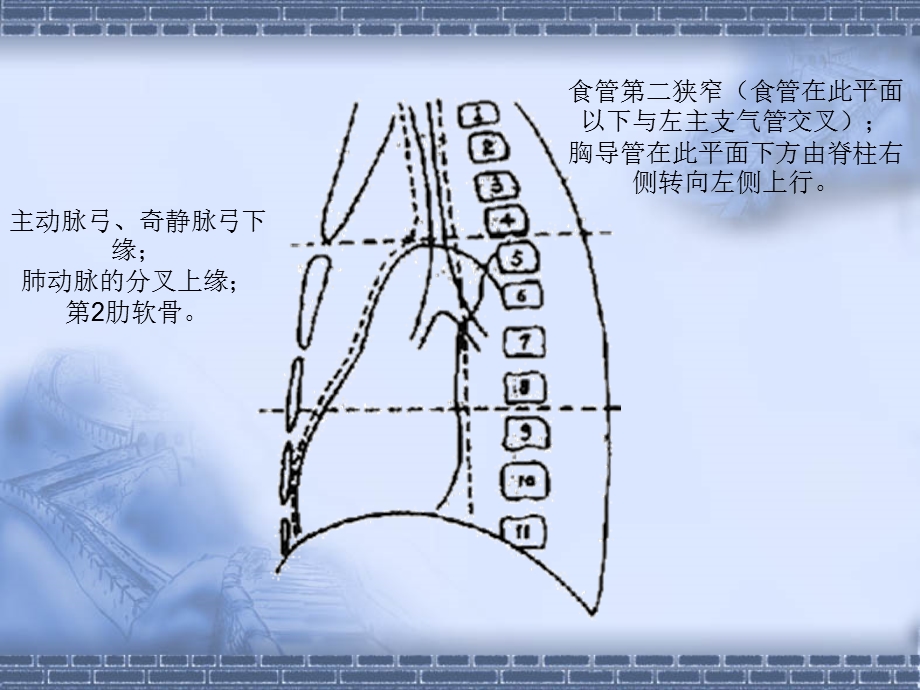 CT纵隔淋巴结分区.ppt_第3页