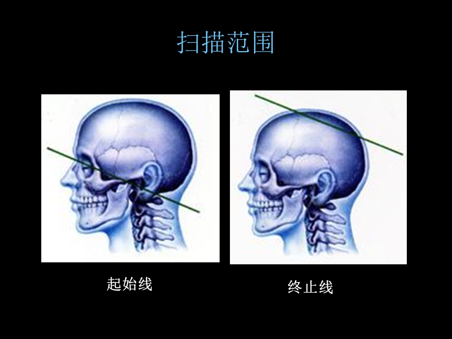 CT影像教学片-实验.ppt_第2页