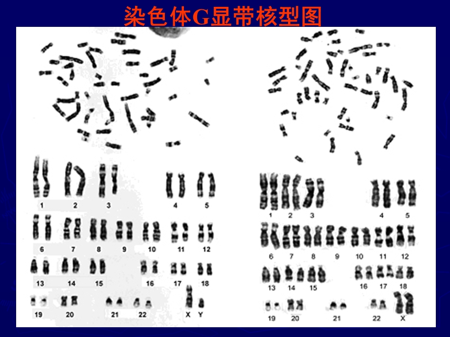 染色体G显带技术及其原理.ppt_第2页