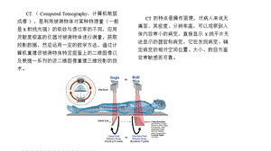 CT技术在医学领域的应用.ppt