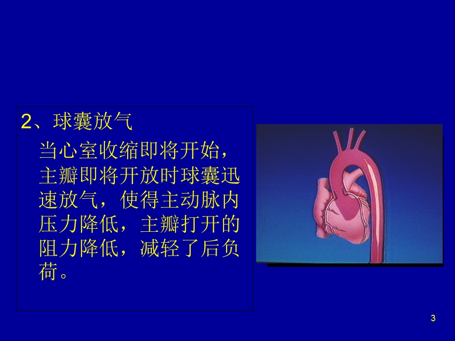 IABP使用常见问题.ppt_第3页