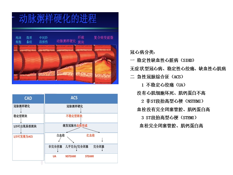 AHA双联抗血小板药物指南第一部分.ppt_第2页