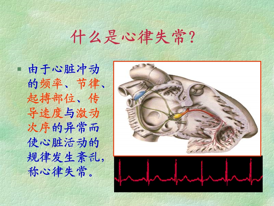 ICU常见之心律失常.ppt_第2页