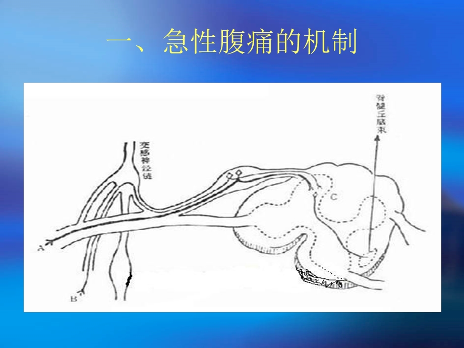 外 科 急 腹 症.ppt_第3页