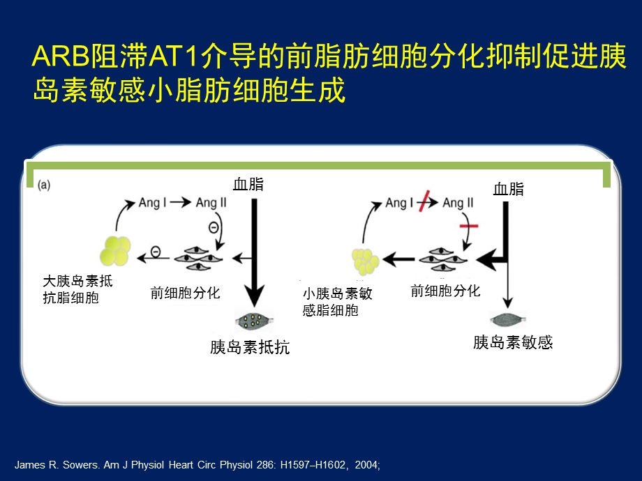 ARB降低新发糖尿病的作用机制.ppt_第3页