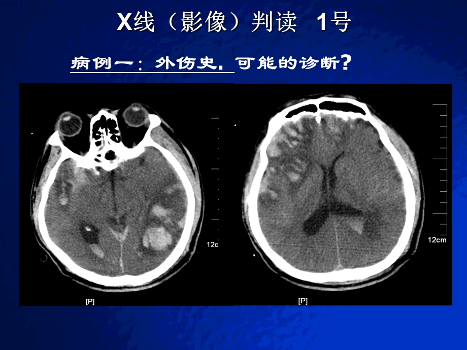 2015住院医师临床技能考核辅助判读部分.ppt_第3页